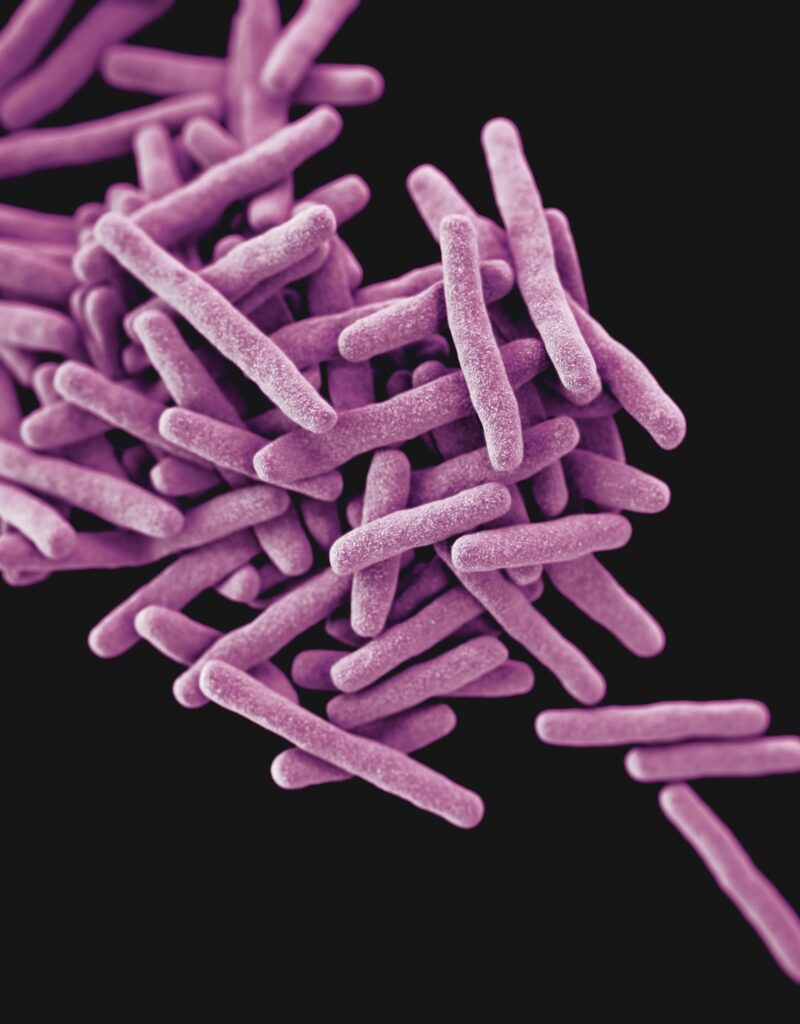 Bakterie w „Przekroju”