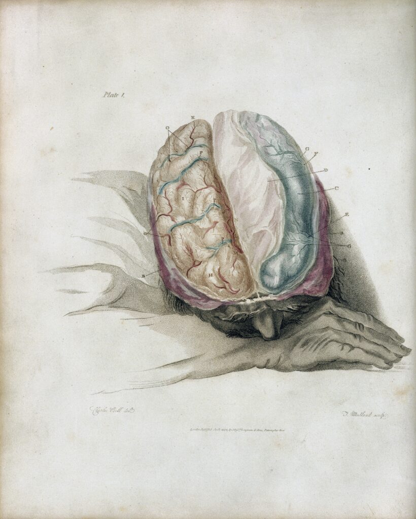 As Stubborn as a Brain