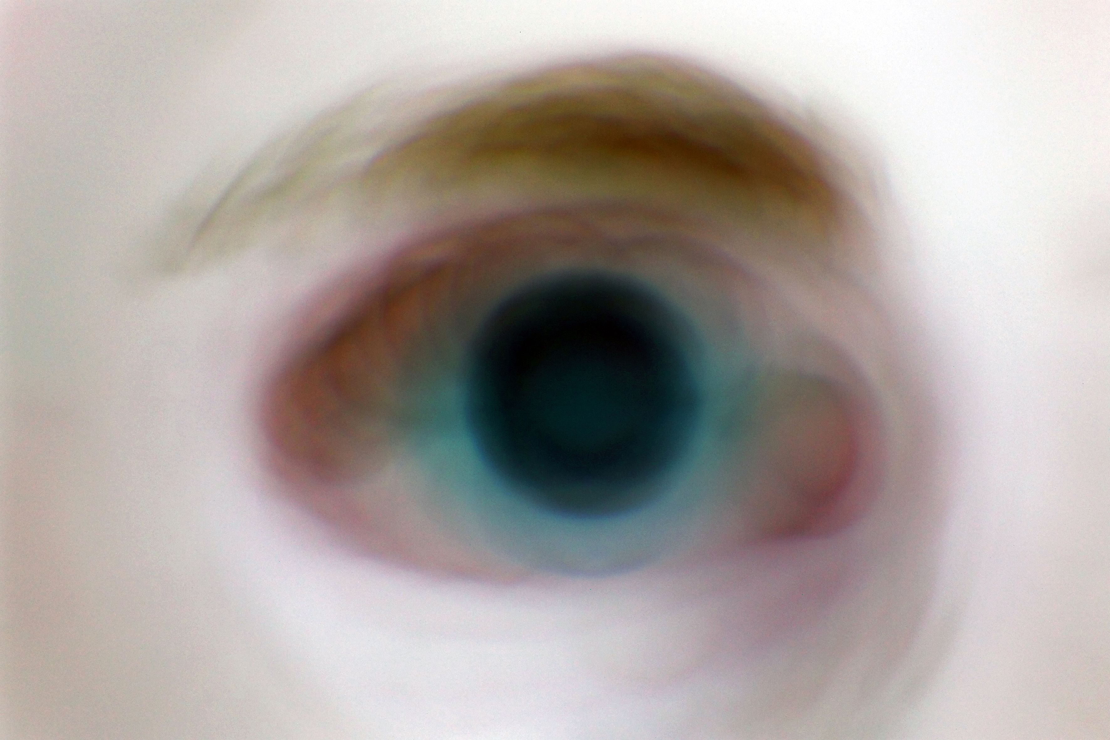 From Eye to Bone