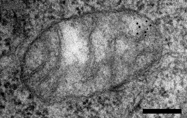 Nasza rozmówczyni. Czarne kropki to jej DNA, a właściwie cząsteczki złota, które przyczepiają się do DNA. Zdjęcie wykonane metodą mikroskopii elektronowej; zdjęcie: Francisco J. Iborra/Hiroshi Kimura/Peter R. Cook/BioMed Central Ltd., https://bmcbiol.biome