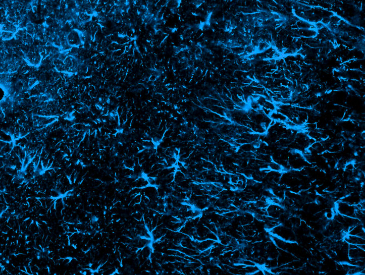 2. Zabarwione komórki glejowe w mózgu szczura; zdjęcie: Orchinik Lab, Arizona State University – Creative Commons